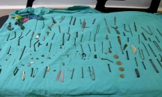 Midesinden 158 yabancı cisim çıkarıldı